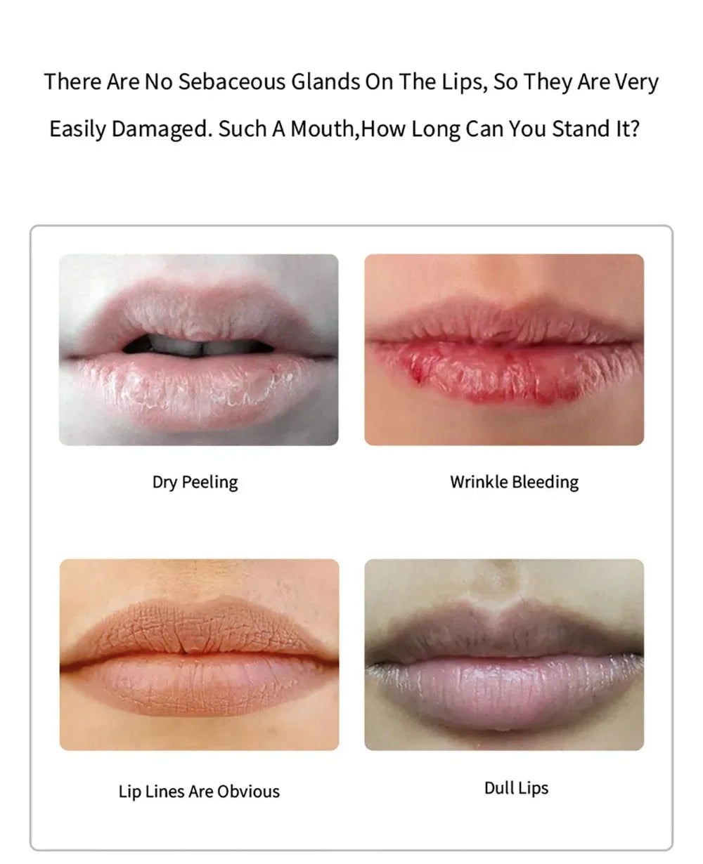 20pcs Cherry Vitamin Lip Masks – Moisturizing Lip Patches with Cherry Extract to Brighten Remove Dead Skin & Improve Dry Lips Gift for Women