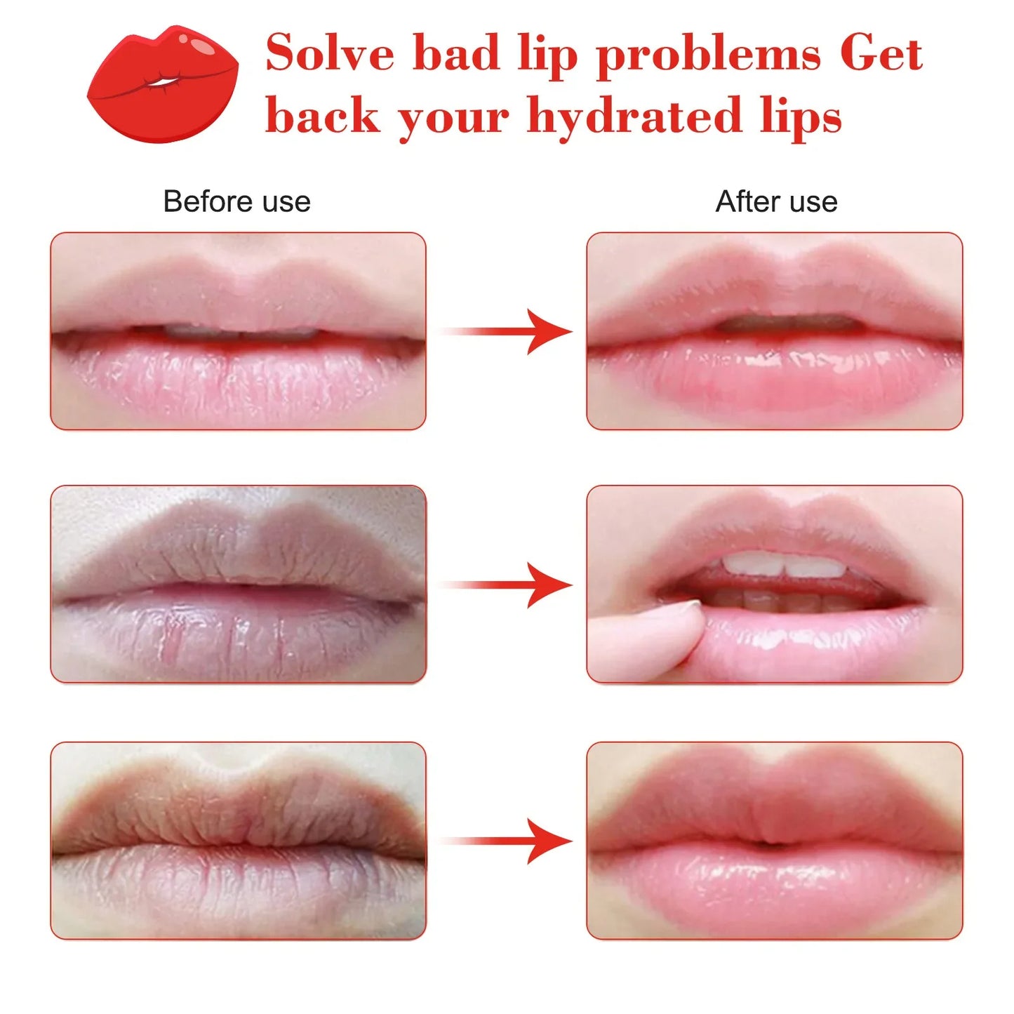 20pcs Cherry Vitamin Lip Masks – Moisturizing Lip Patches with Cherry Extract to Brighten Remove Dead Skin & Improve Dry Lips Gift for Women